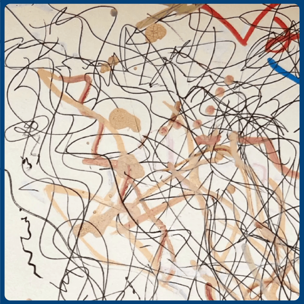 The Great Emu War Casualties - Public Sweetheart No. 1